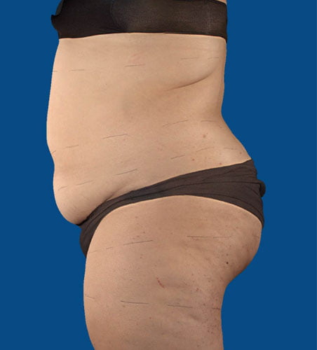 Reduce weight with UltraSlim and UltraSmooth