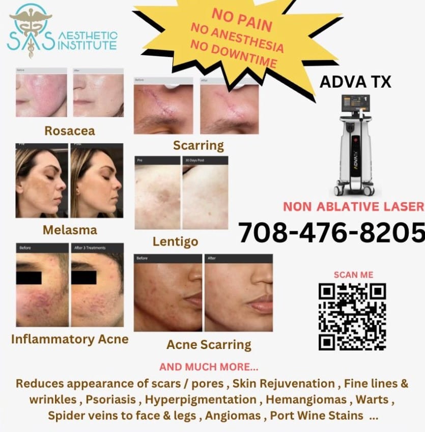 skin resurfacing services frankfort il