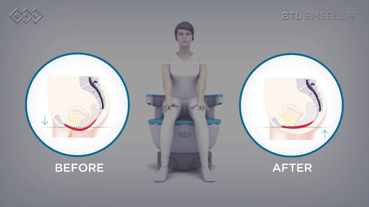 urinary incontinence treatment in orland park il