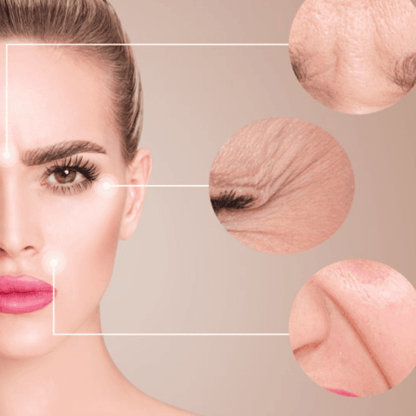 wrinkle treatment in Mokena, IL
