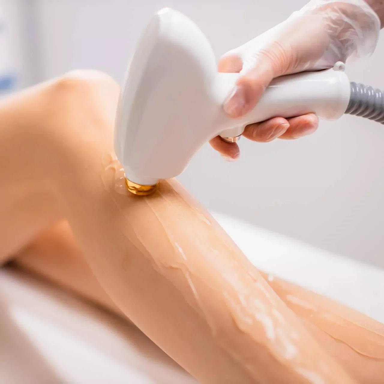 Laser Hair Removal in Mokena Laser Hair Removal in Mokena