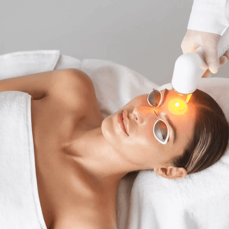 advatx laser acne treatment in mokena