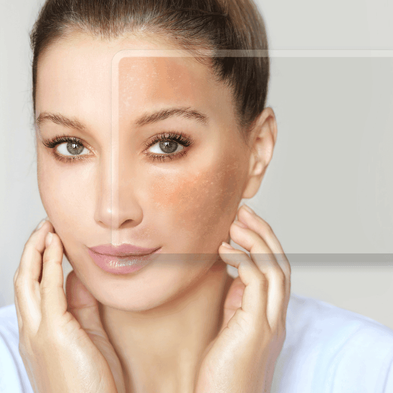skin pigmentation treatment in mokena skin pigmentation treatment in mokena