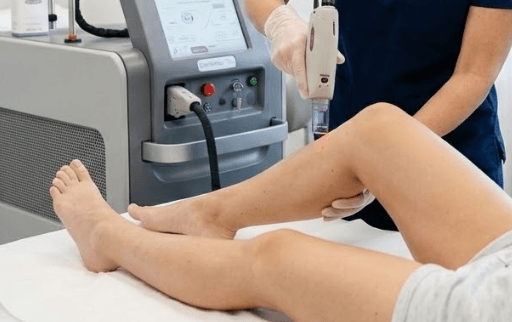 Laser Hair Removal Near New Lenox IL Laser Hair Removal Near New Lenox IL